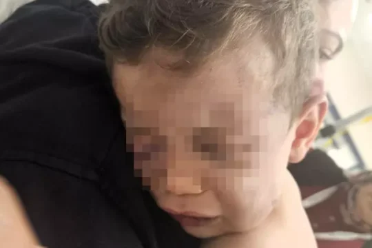 son dakika, son dakika haberleri, türkiye son dakika haberleri, aren bebek